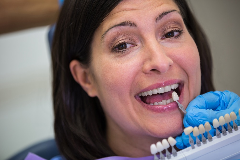 dentist showing porcelain veneers