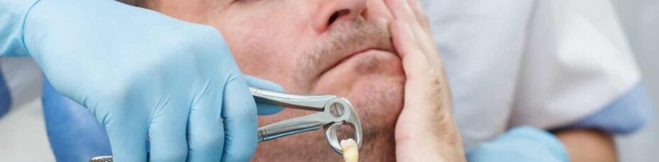 tooth extractions in SW Calgary