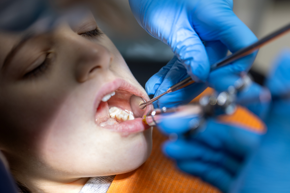 Tooth Extractions in SW Calgary