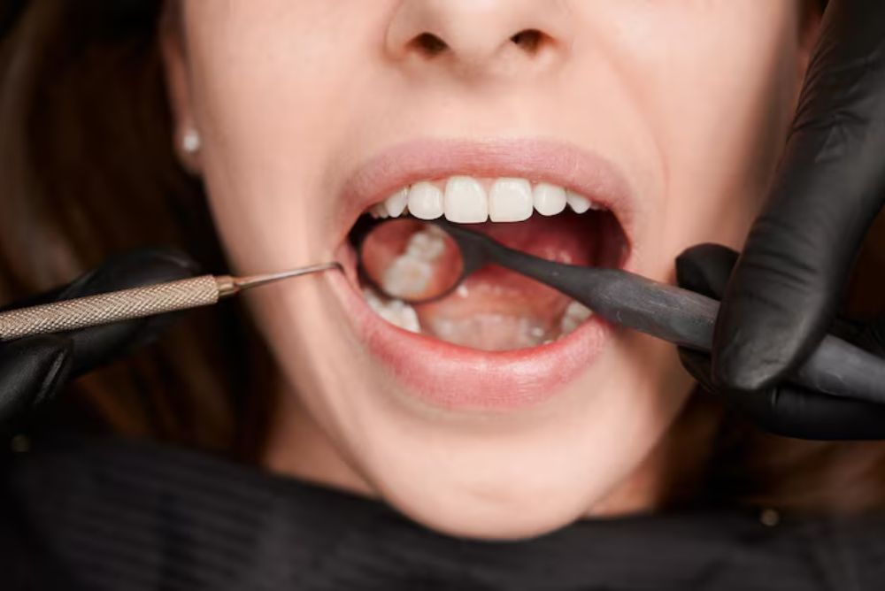 dentist performing a tooth extraction procedure to safely remove a damaged tooth